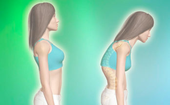 Что такое грудинно-ключично-сосцевидная мышца и как она связана с плохой осанкой? Что такое грудинно-ключично-сосцевидная мышца и как она связана с плохой осанкой?