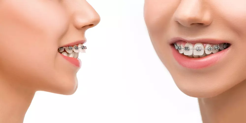 Проблемы с неправильным прикусом.