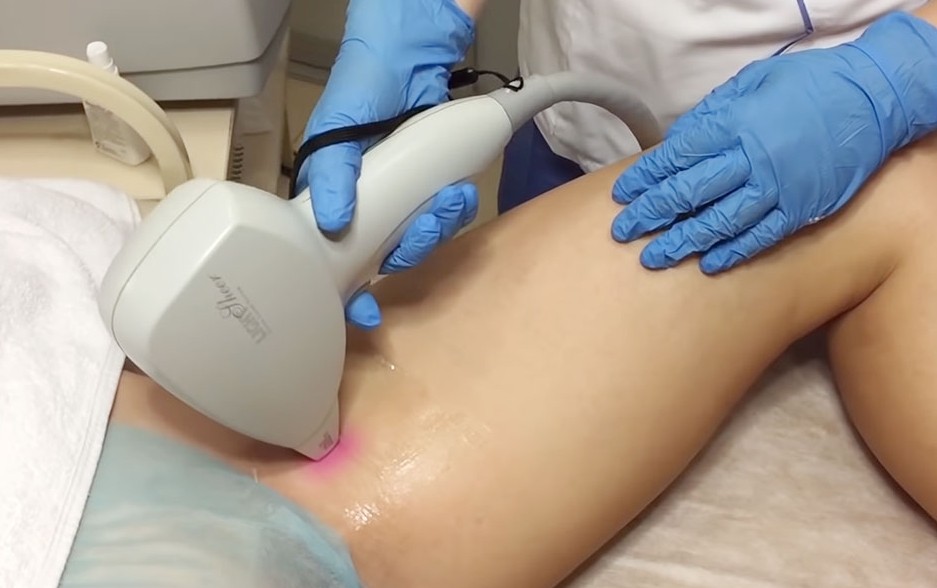 Умерщвление волос в интимной зоне разными методами