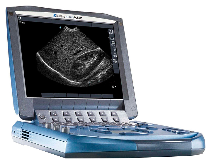 Аппарат УЗИ Fujifilm Sonosite MicroMaxx - купить в интернет магазине ENTERO.RU