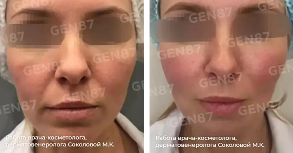 Программа омоложения: как вернуть молодость коже? Программа омоложения: как вернуть молодость коже?