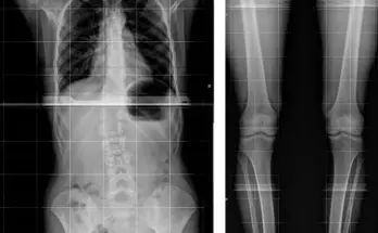 Рентген на дому в СПб: комфорт и удобство