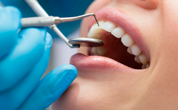 Проблемы зубов и необходимость лечения