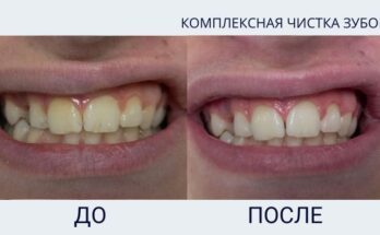 Проблемы с зубами