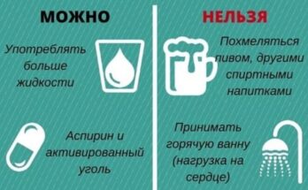 Причины похмелья Причины похмелья