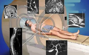 МРТ диагностика: что это такое и как проходит процедура МРТ диагностика: что это такое и как проходит процедура