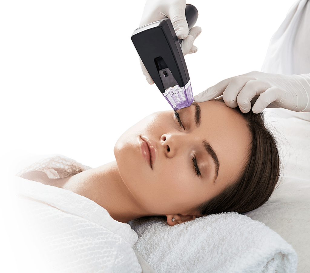 Микроигольчатый RF-лифтинг: секрет омоложения кожи с Морфеус 8 Микроигольчатый RF-лифтинг: секрет омоложения кожи с Морфеус 8