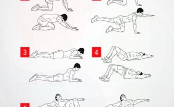 Профилактика болей в спине и шее