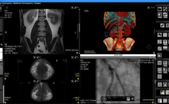 Универсальность и доступность вашего DICOM-вьюера Универсальность и доступность вашего DICOM-вьюера