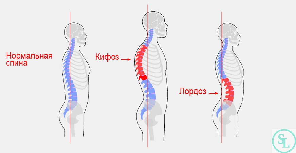 Основные причины боли в спине