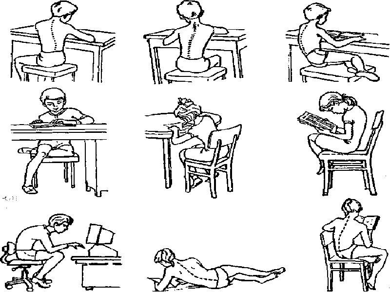 Как уберечь себя от сколиоза