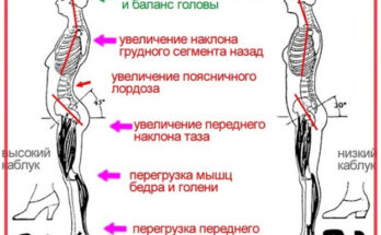 Избавляемся от боли в спине Избавляемся от боли в спине