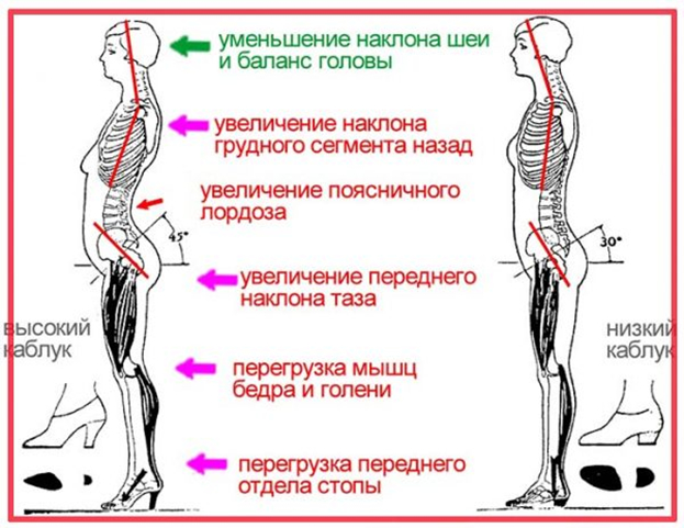 Избавляемся от боли в спине Избавляемся от боли в спине