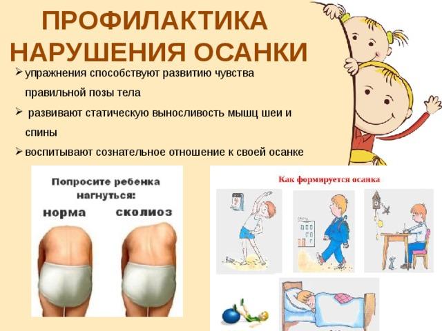 Профилактика сколиоза у детей