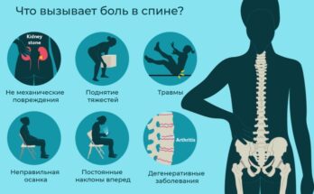Основные причины боли в спине