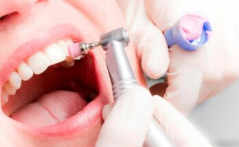 Значение профессионального лечения зубов для здоровья