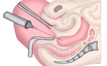 Обзор платформы ARImed и её возможности