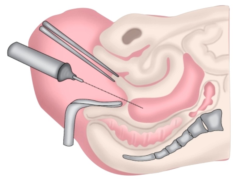 Обзор платформы ARImed и её возможности